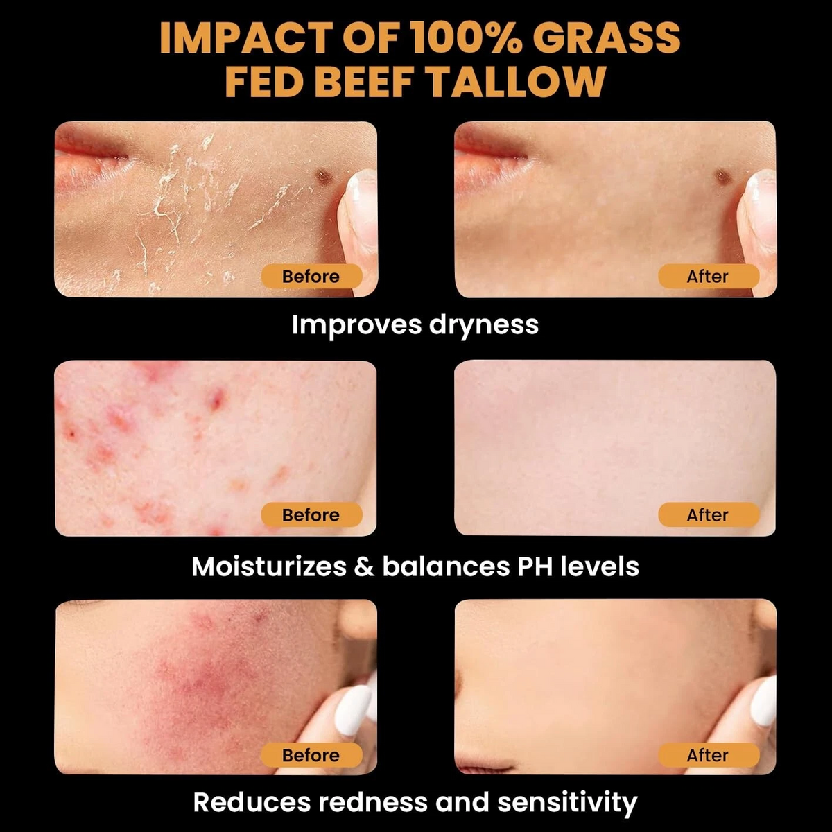 Organic Grass-Fed Beef Tallow Balm with Raw Honey - Moisturizing Cream for Soft, Smooth Skin - Handmade All-Natural Moisturizer 57g.
