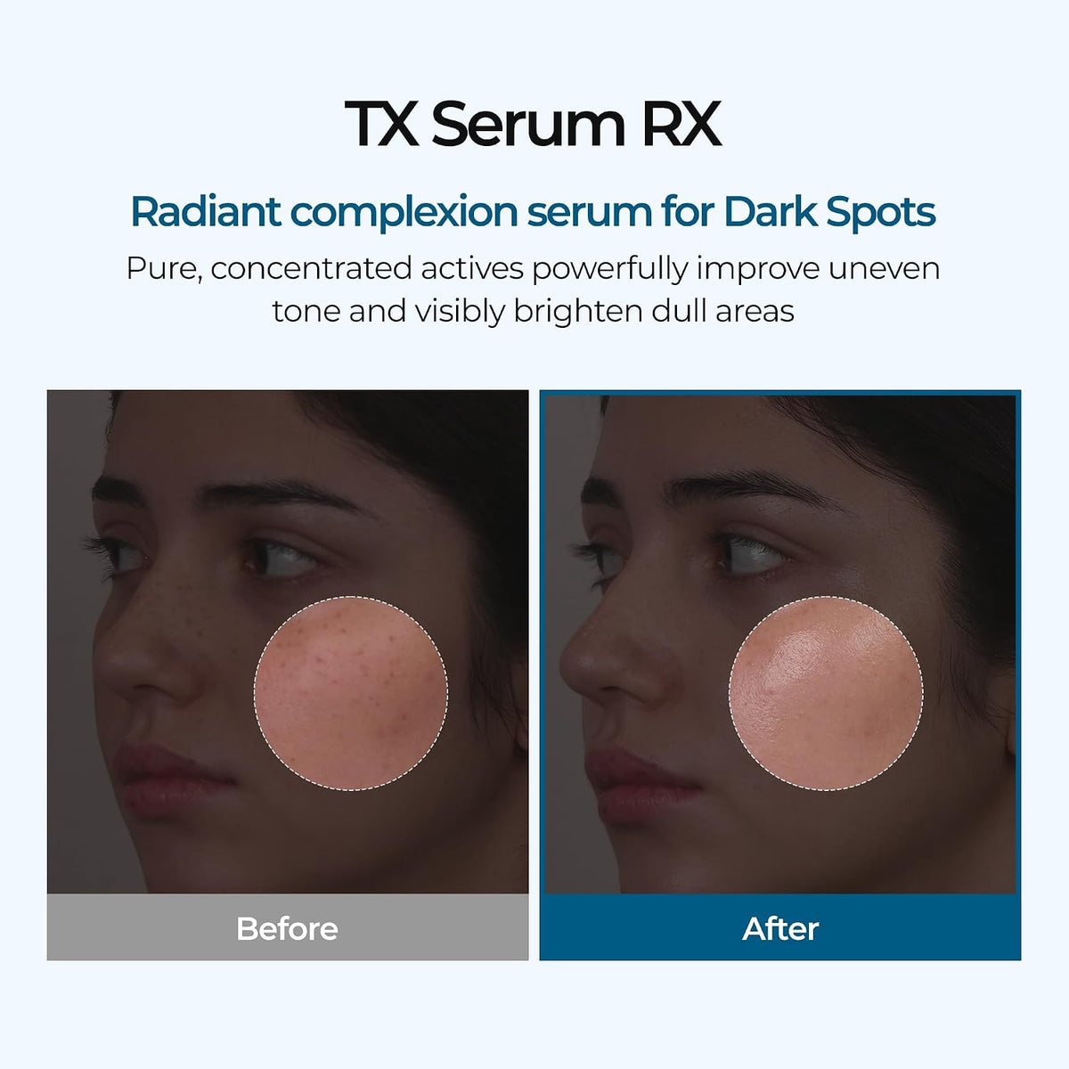 TX ampoule RX facial ampoule 30ml Rx (K-Beauty )Reduce Wrinkles, Dark Spots